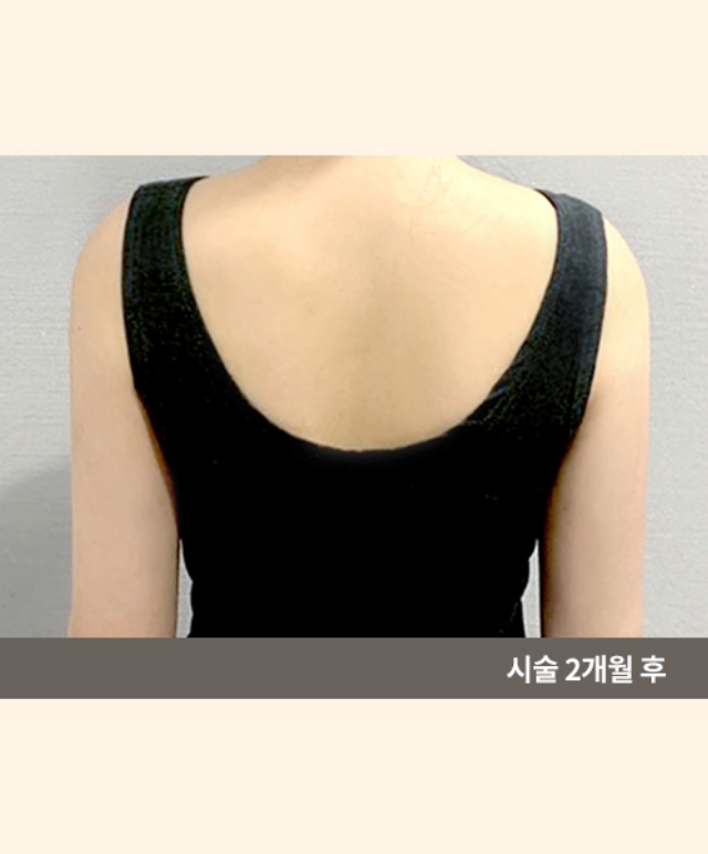 Tune Body