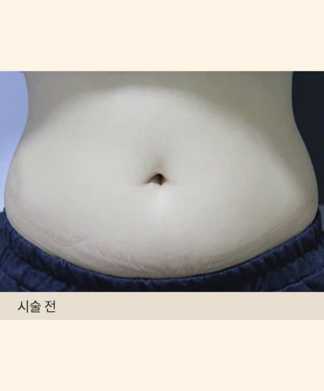 Postpartum Diet Program